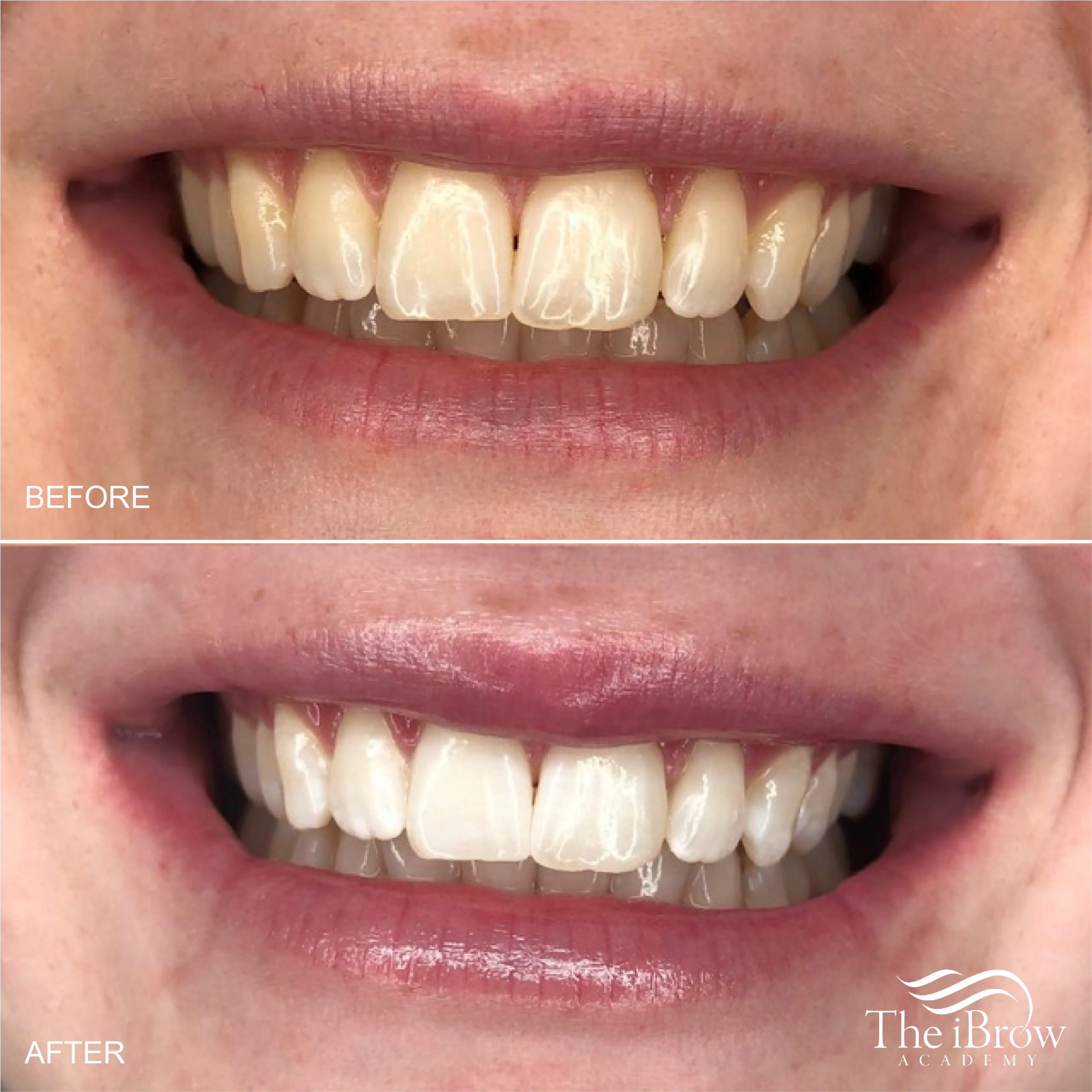 33183 maintaining bright smile