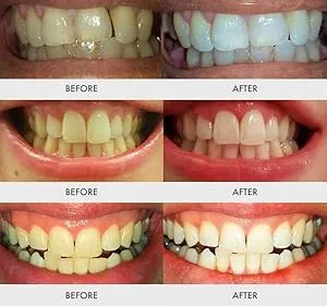 33187 healthy smile