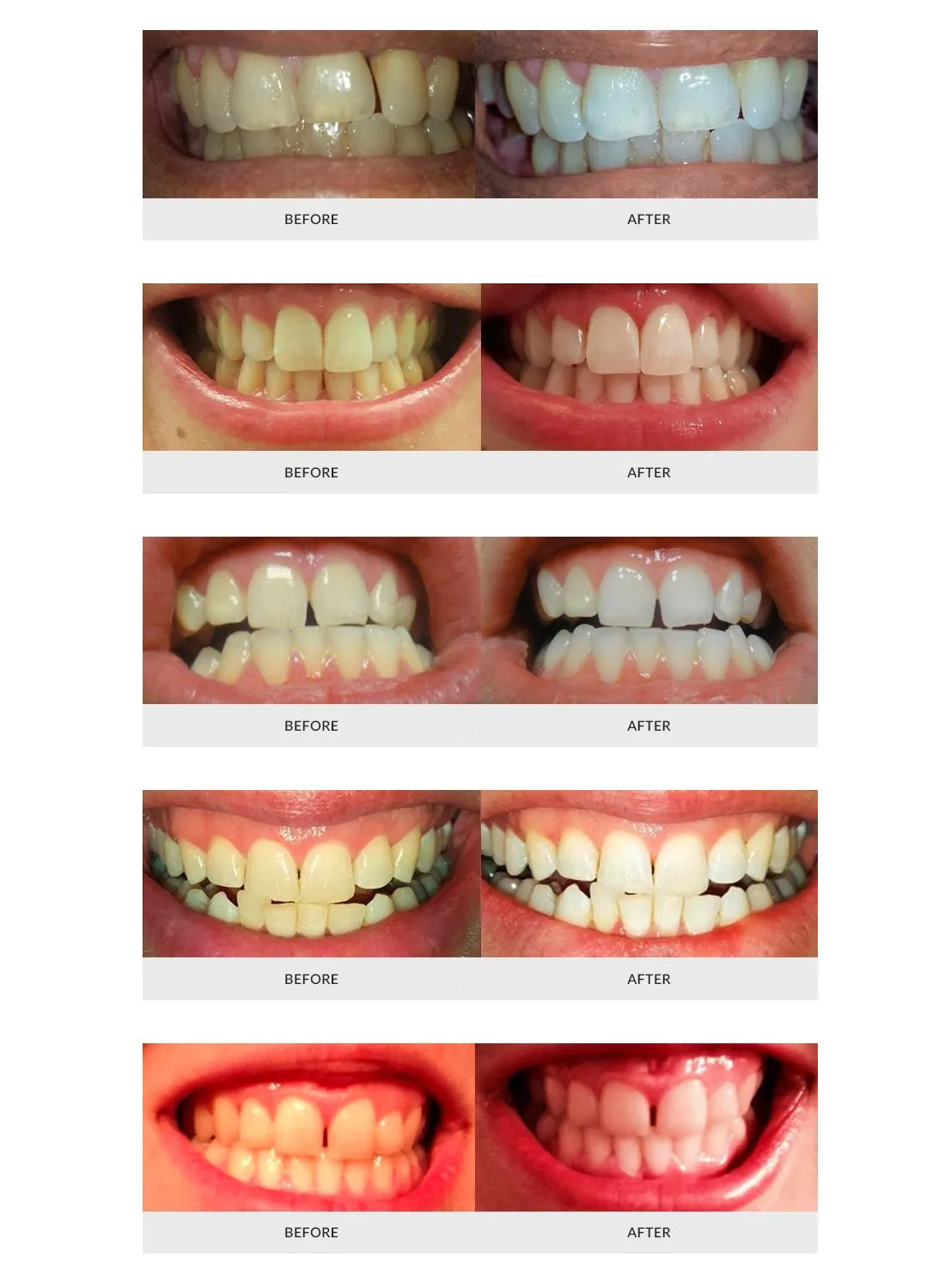 33187 sensitive teeth