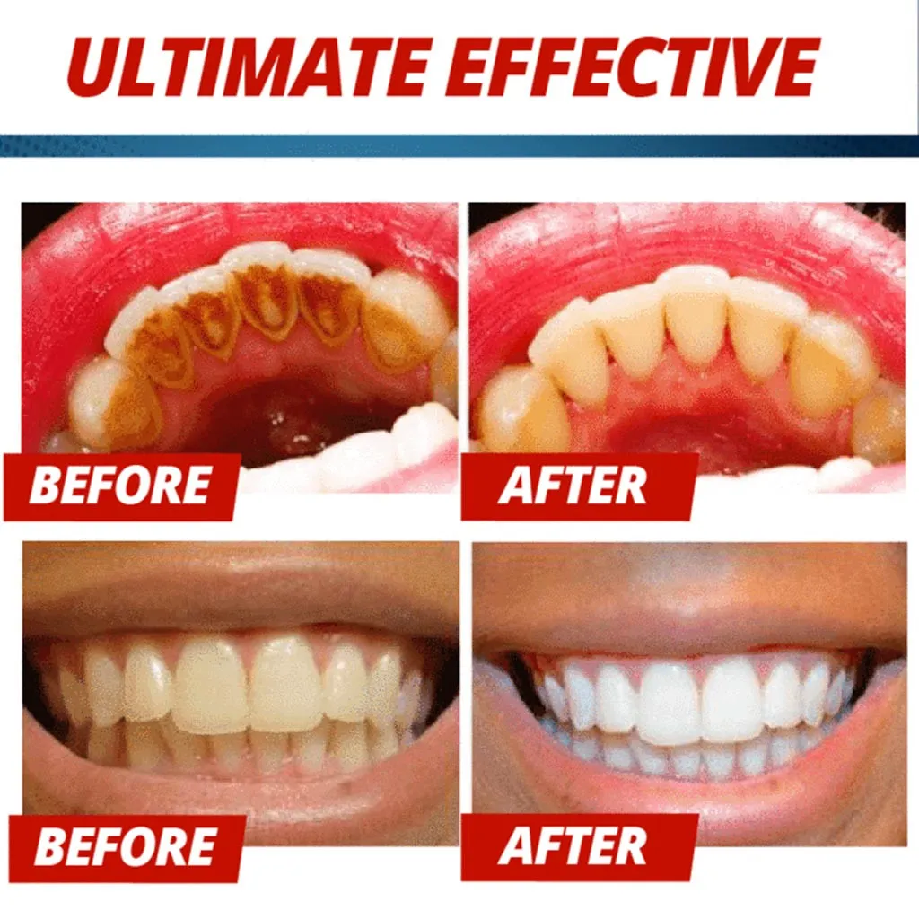 33188 whitening toothpaste