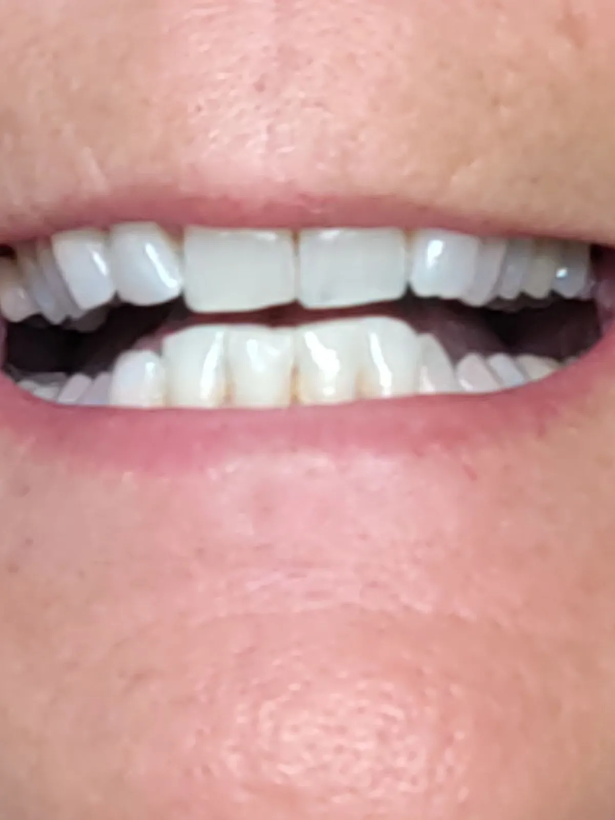 /img/33189-mouthwash-and-rinsing.webp