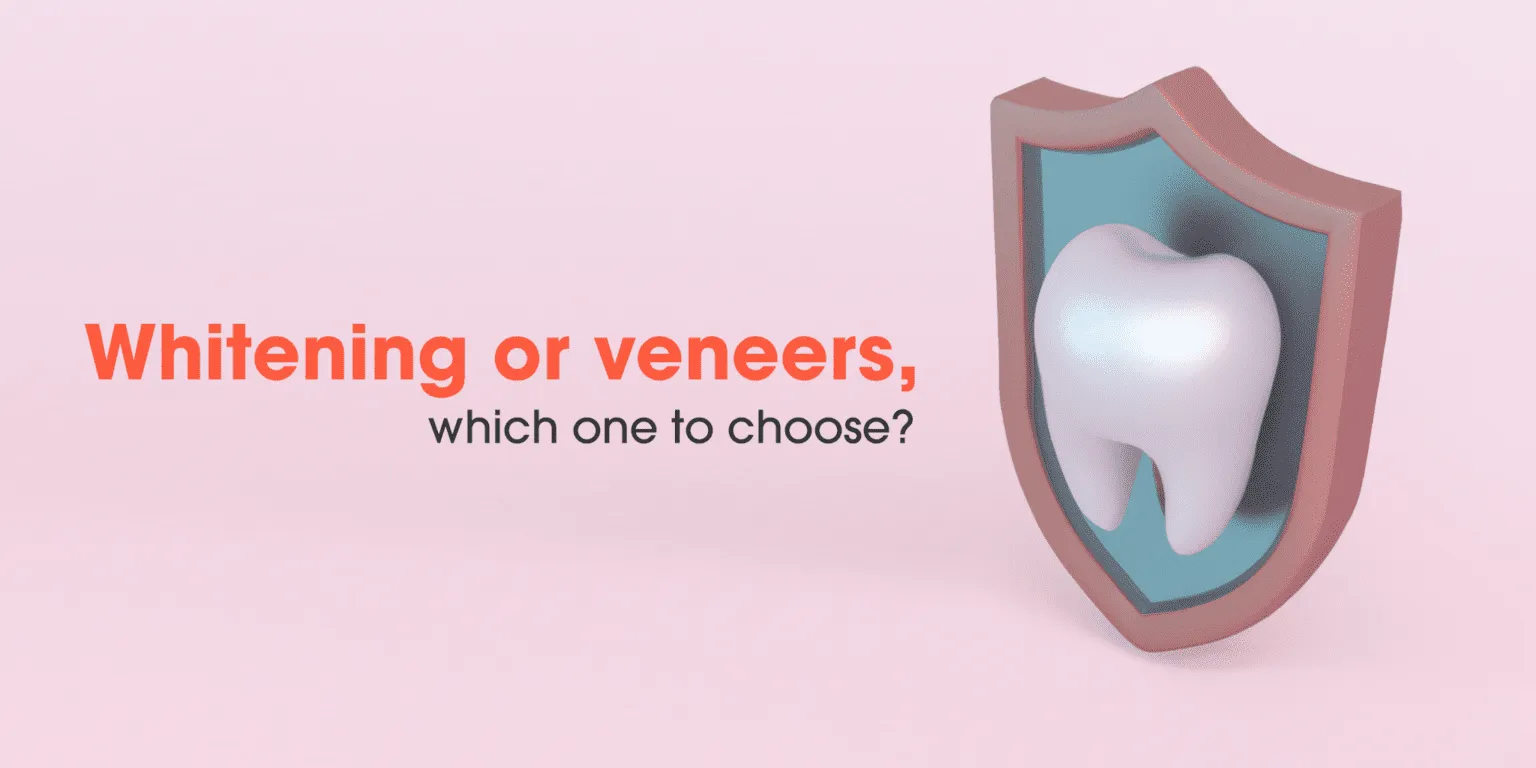 /img/33192-veneer-whitening-expectations.webp
