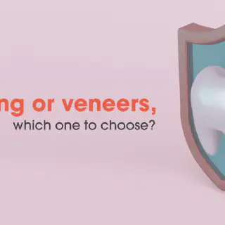 /img/33192-veneer-whitening-expectations.webp