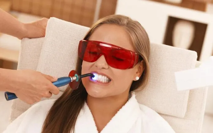 33193 teeth whitening uk