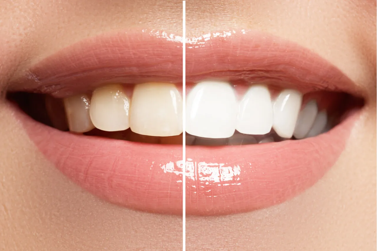 33194 gum irritation
