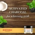 33200 teeth whitening results