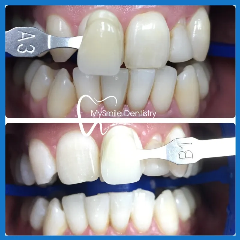 /img/33201-healthy-smile.webp