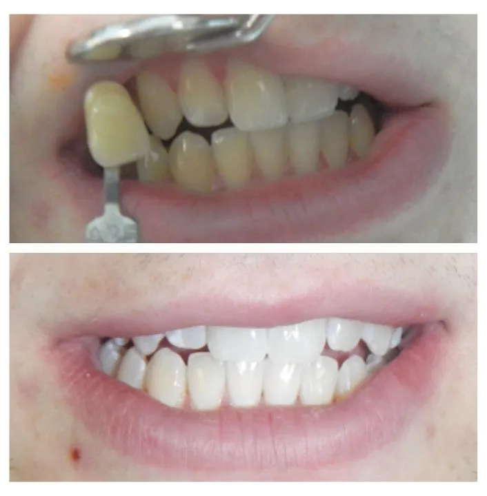 /img/33203-healthy-smile.webp