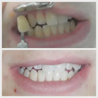/img/33203-healthy-smile.webp