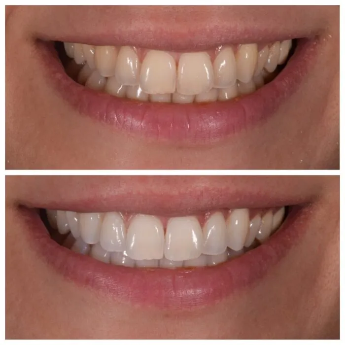 33204 dental aftercare