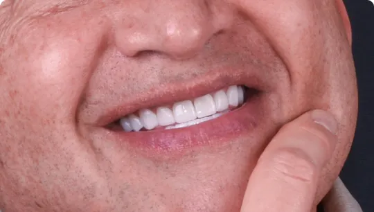 33205 teeth whitening indonesia clinic