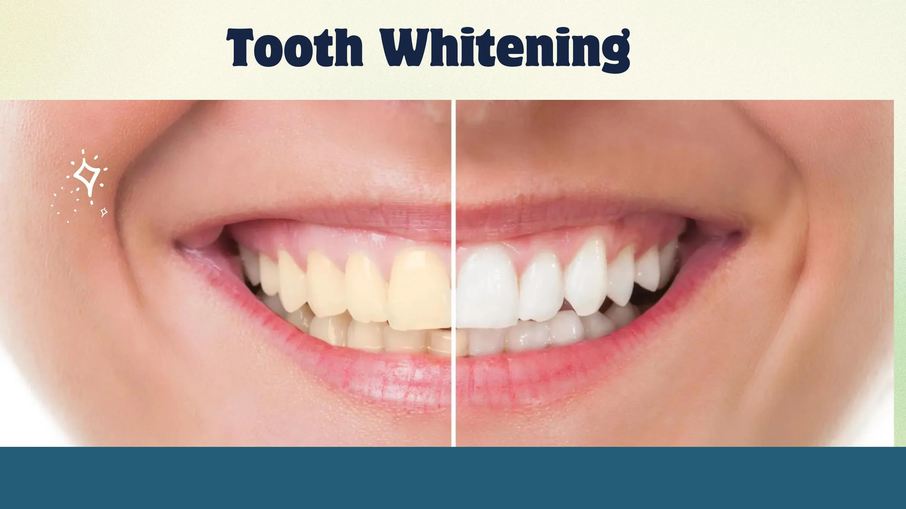 33207 bright smile teeth whitening dc