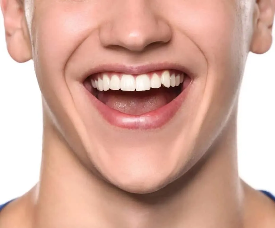 33207 in office teeth whitening dc