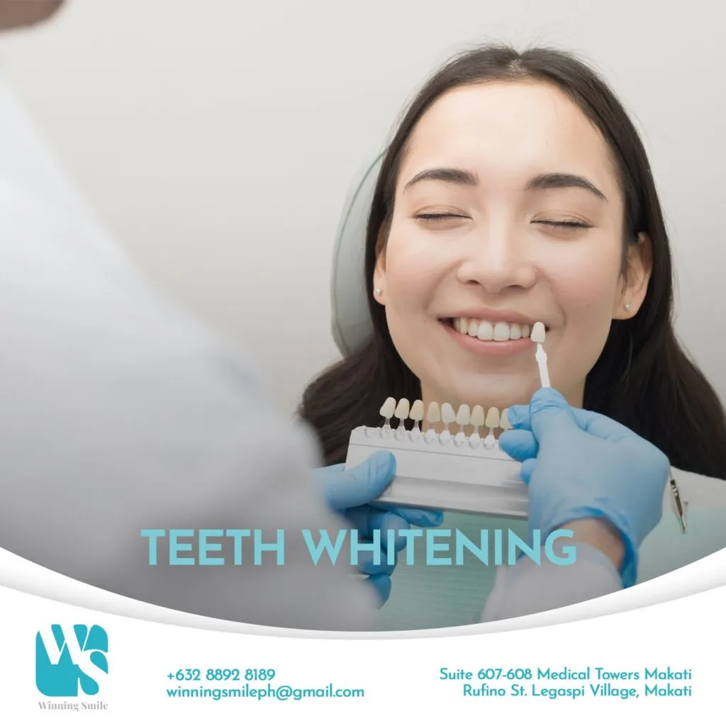 33213 teeth whitening philippines comparison