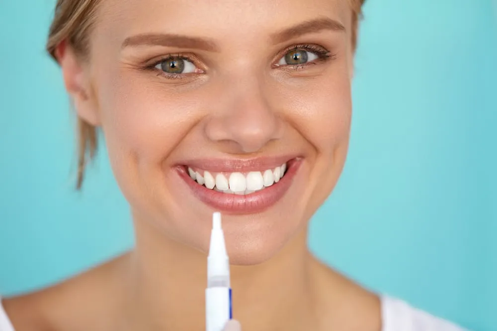 33216 teeth whitening at dentist overview