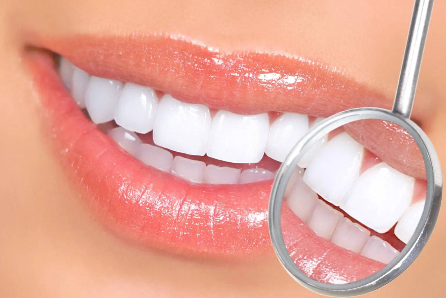 33217 gentle teeth whitening smiling