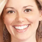 33218 teeth whitening smile