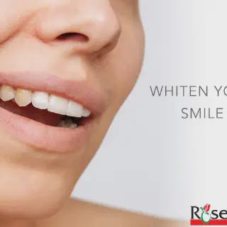 /img/33221-dental-checkup.webp