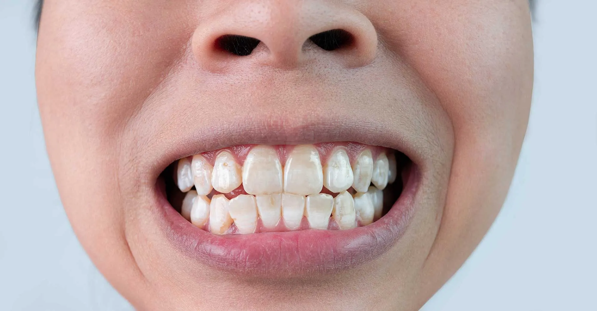 33221 proper oral hygiene