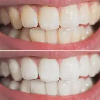 /img/33224-staining-prevention.webp